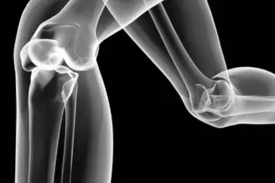 Masteling Fysiotherapie Amsterdam sportblessure hardlopen begeleiding analyse behandeling